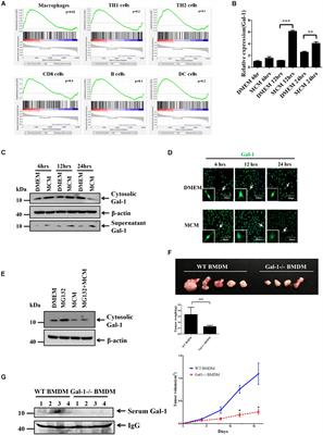 Autophagy Drives Galectin-1 Secretion From Tumor-Associated Macrophages Facilitating Hepatocellular Carcinoma Progression